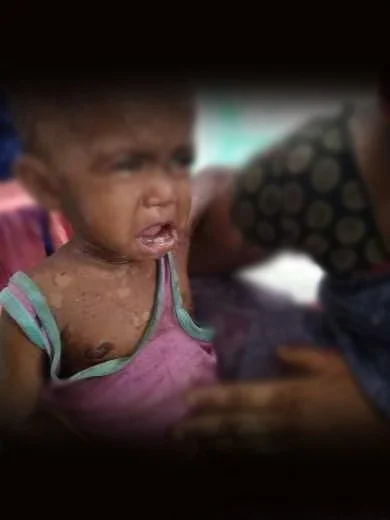 Image of Child suffering with disease